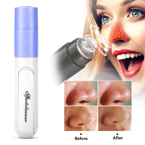 Acne Blackhead Remover Electric Face Massage Cleaner